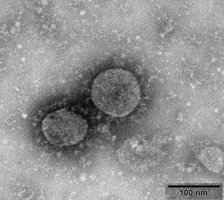 W020200127417305730682 - coronavirus.jpg